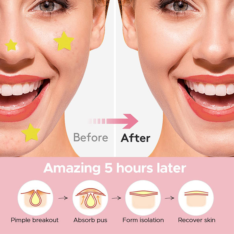 600 PCS/Set Star Pimple Patch  - Beauty Makeup Tool recension och pris